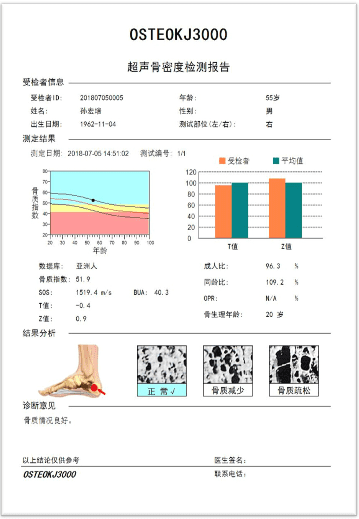 科进超声骨密度仪20-100岁患者检测报告