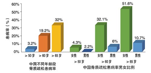 女性骨质数据