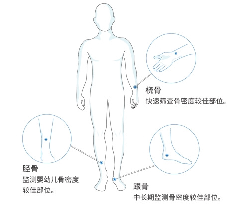 超声骨密度测定仪检测部位